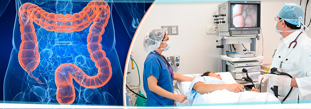 Colonoscopy in Fort Pierce